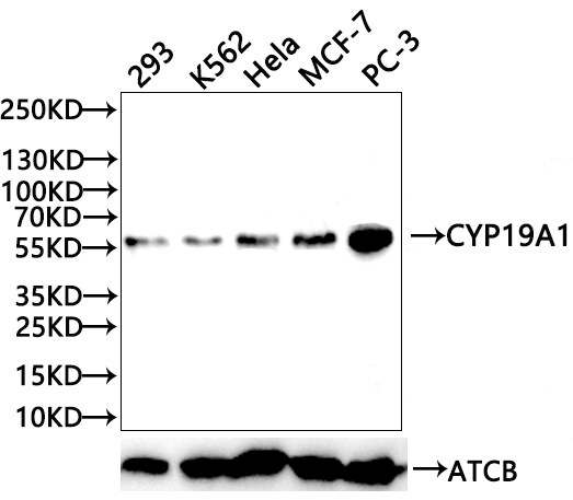 Aromatase Antibody (1H1)