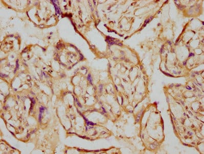 Aromatase Antibody (1H1)