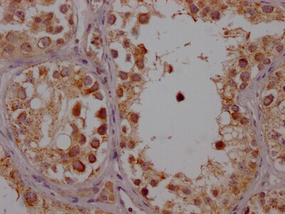 Cytochrome P450 17A1 Antibody (5A9)