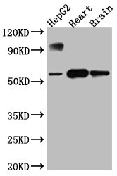 Cytochrome P450 17A1 Antibody (5A9)