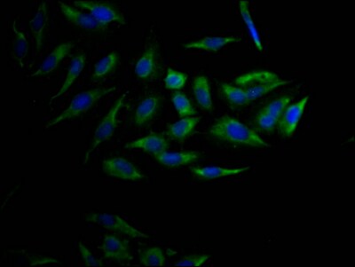 Cytochrome P450 17A1 Antibody (5A9)