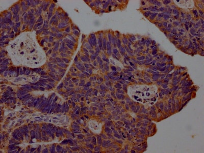 CXCL10/IP-10/CRG-2 Antibody (5C7)