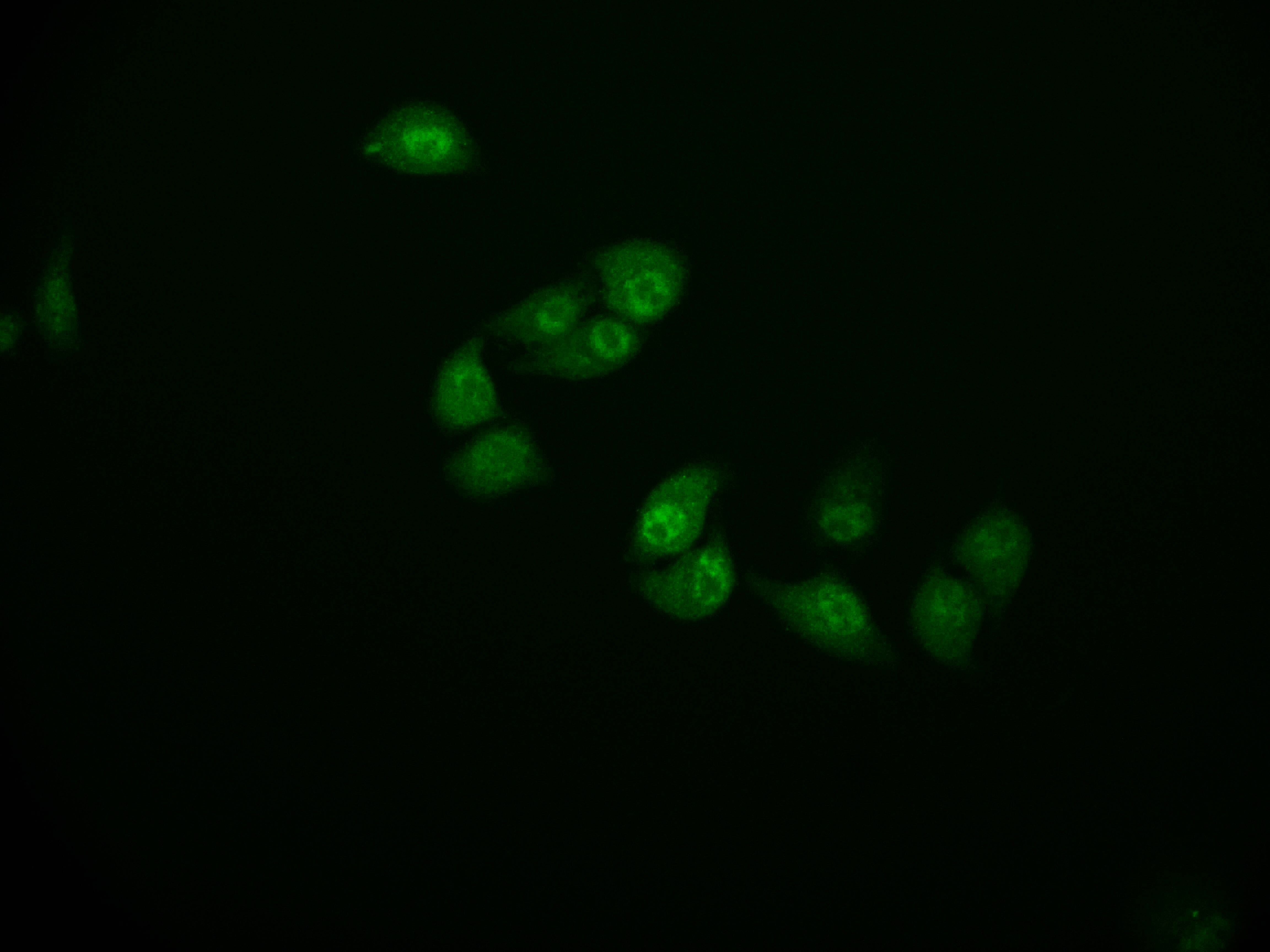 Cystatin B/Stefin B Antibody (11H4)