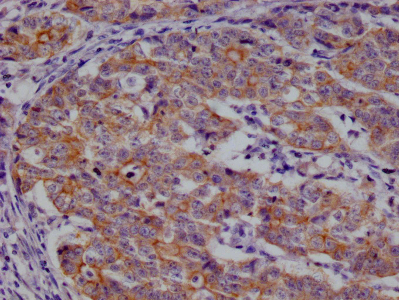 beta Casein Antibody (29D6)