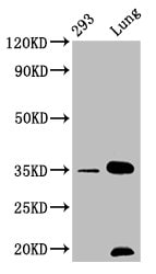 Calponin 1 Antibody (2H1)