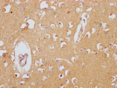 Clusterin/APOJ Antibody (2A1)
