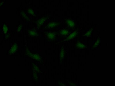 Chk1 Antibody (2F2)