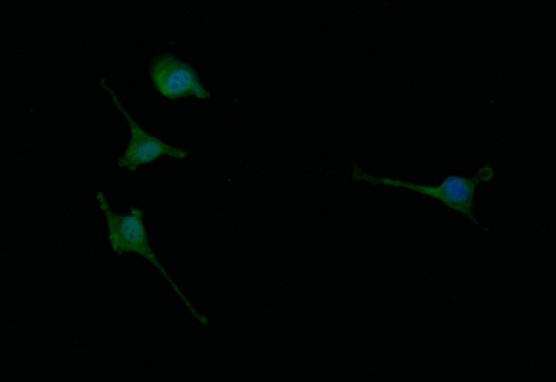 Choline Acetyltransferase/ChAT Antibody (8E7)
