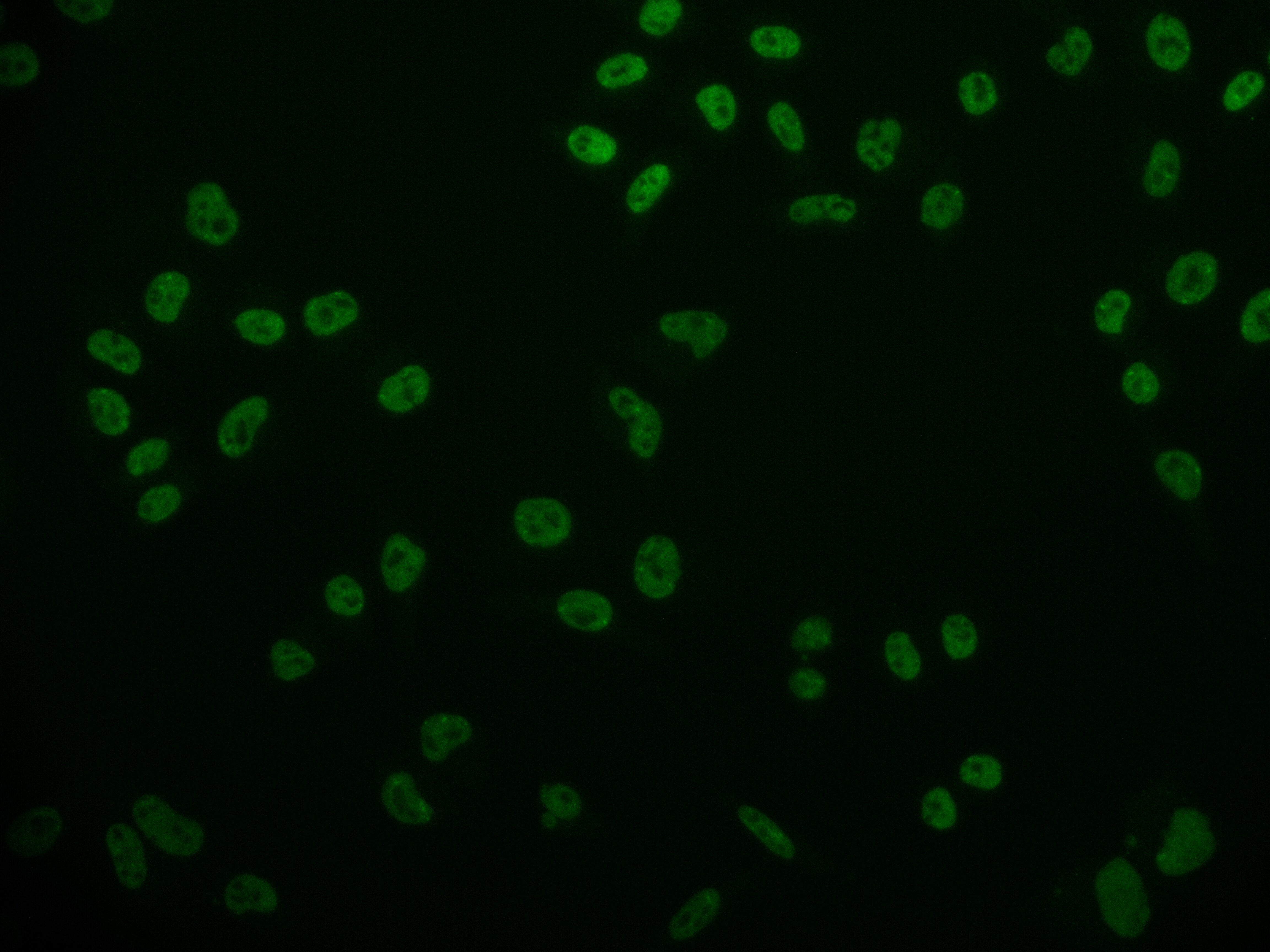 Cdx1 Antibody (11E10)