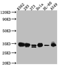 CDK2 Antibody (6A5)