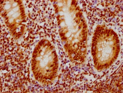 CDC5L Antibody (1E3)