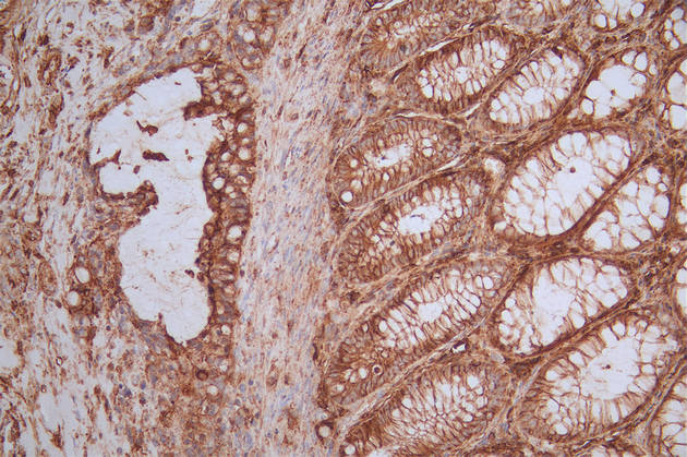 CD44 Antibody (19H12)