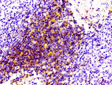 CD4 Antibody (2B7)