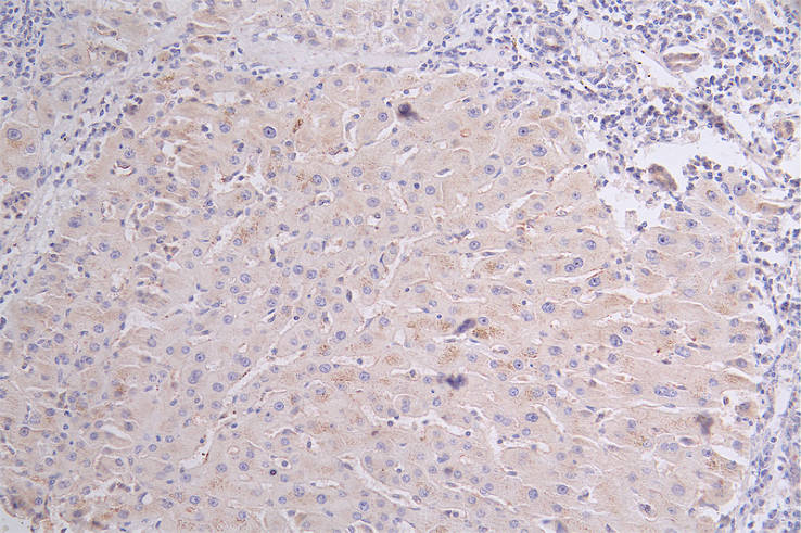 CD36 Antibody (13B12)
