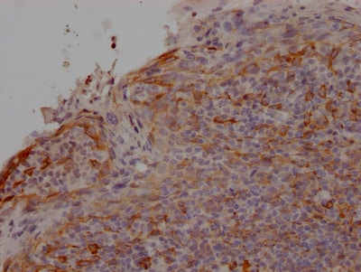 CCR2 Antibody (6A1)