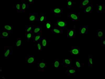 Cyclin E1 Antibody (3A5)