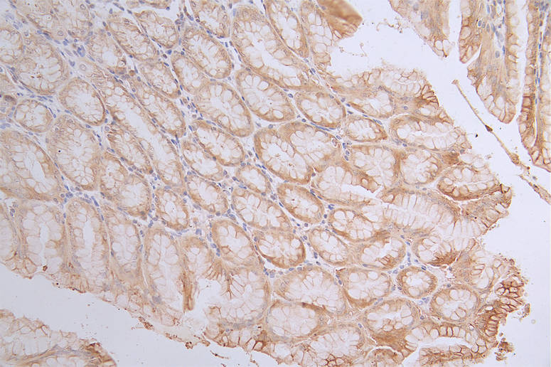 Caspase-3 Antibody (14C1)