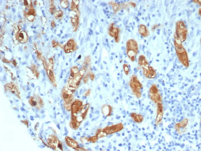 Serpin B5/Maspin Antibody (SERPINB5/4971)