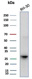 Carbonic Anhydrase III/CA3 Antibody (CA3/7885)