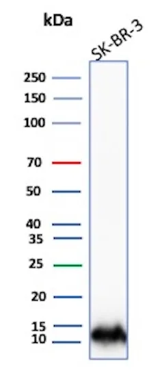 S100A16 Antibody (S100A16/7411)