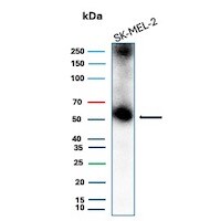 PRAME Antibody (PRAME/9188) Western Blot: PRAME Antibody (PRAME/9188) [NBP3-26783] -