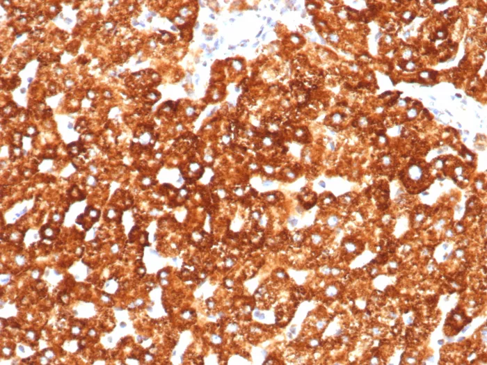 Haptoglobin Antibody (HP/3838)