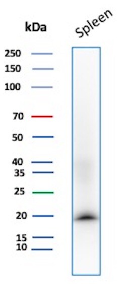 Stathmin 1 Antibody (STMN1/8437) Western Blot: Stathmin 1 Antibody (STMN1/8437) [NBP3-26813] -