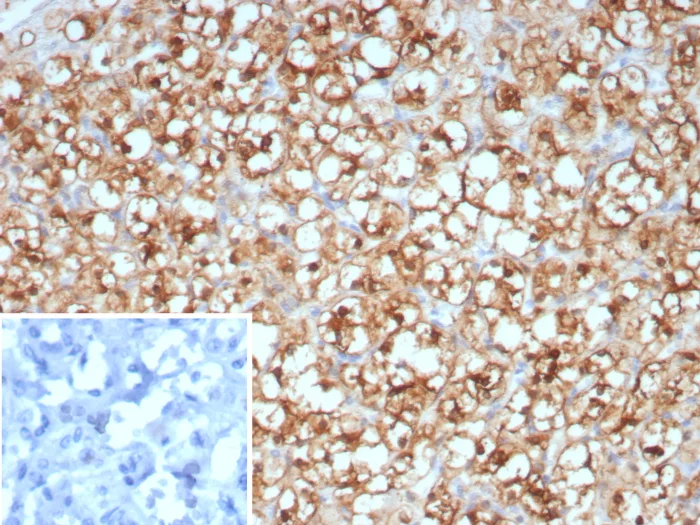 Stathmin 1 Antibody (STMN1/8438)