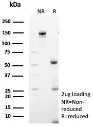 MxA/Mx1 Antibody (MX1/7527)