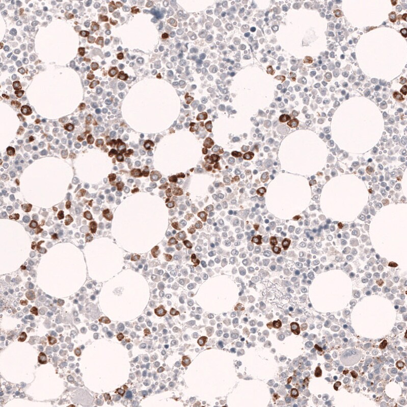 Myeloperoxidase/MPO Antibody (CL14976)