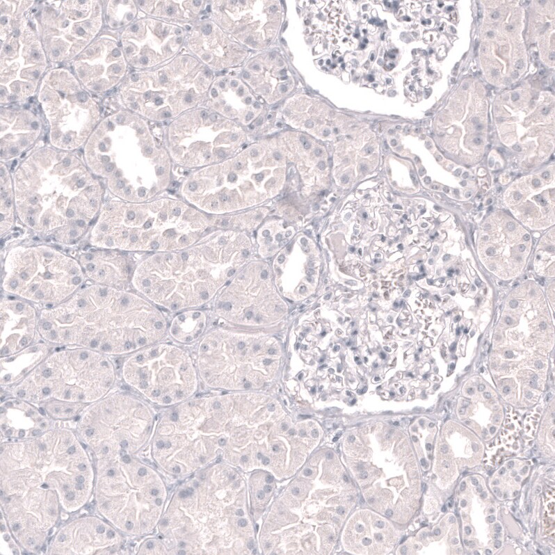 Myeloperoxidase/MPO Antibody (CL14976)