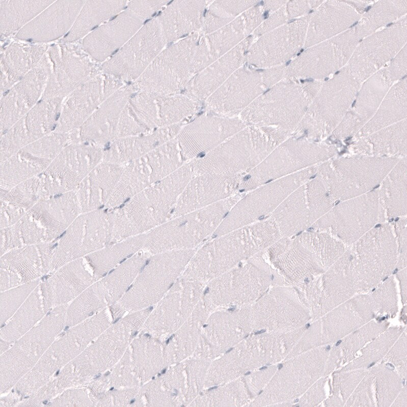 Myeloperoxidase/MPO Antibody (CL14976)