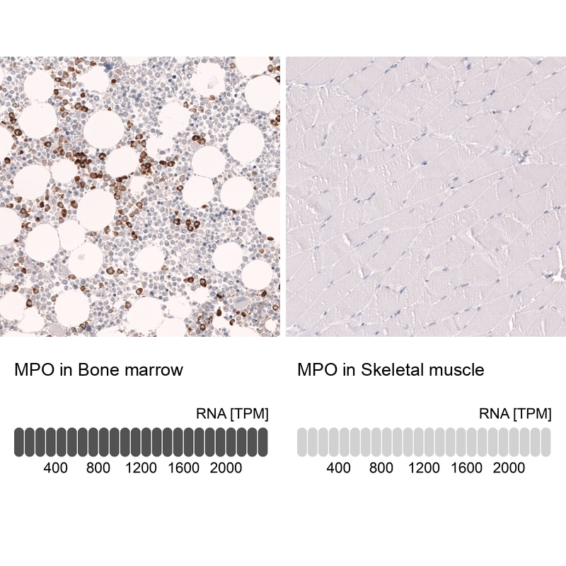 Myeloperoxidase/MPO Antibody (CL14976)