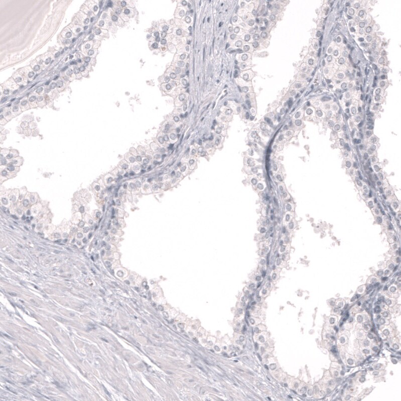 Myeloperoxidase/MPO Antibody (CL14976)