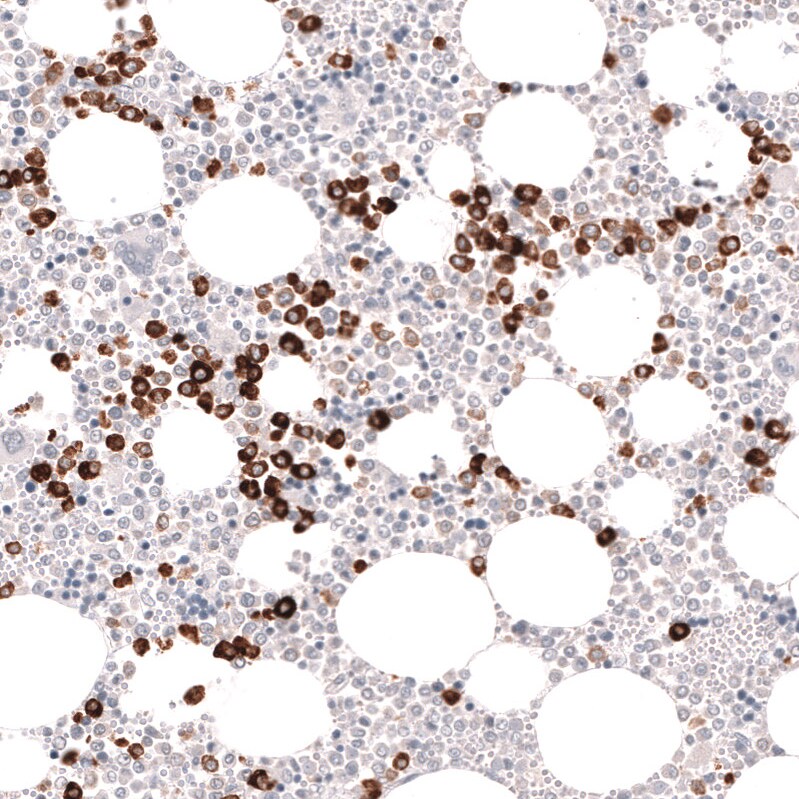 Myeloperoxidase/MPO Antibody (CL14991)