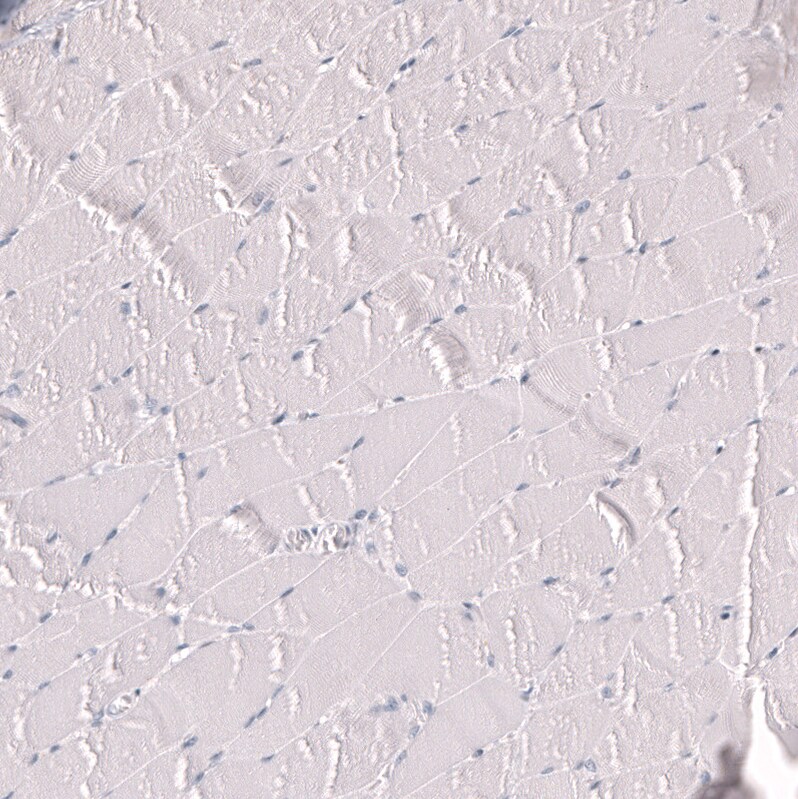 Myeloperoxidase/MPO Antibody (CL14991)