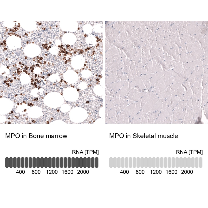 Myeloperoxidase/MPO Antibody (CL14991)
