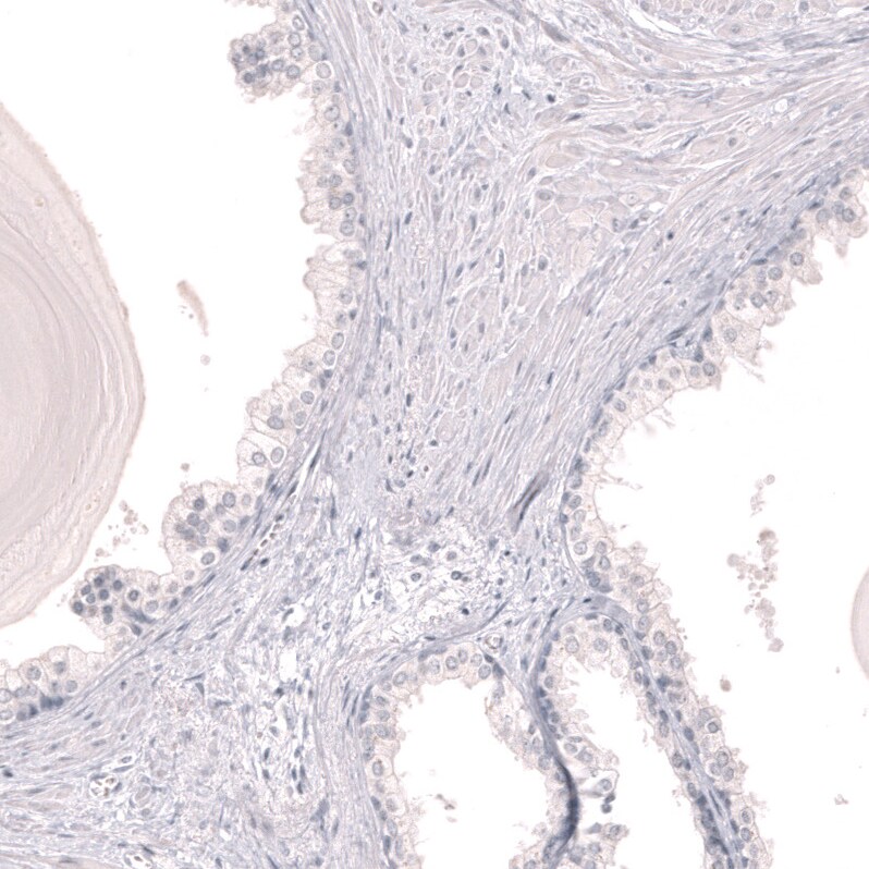 Myeloperoxidase/MPO Antibody (CL14991)