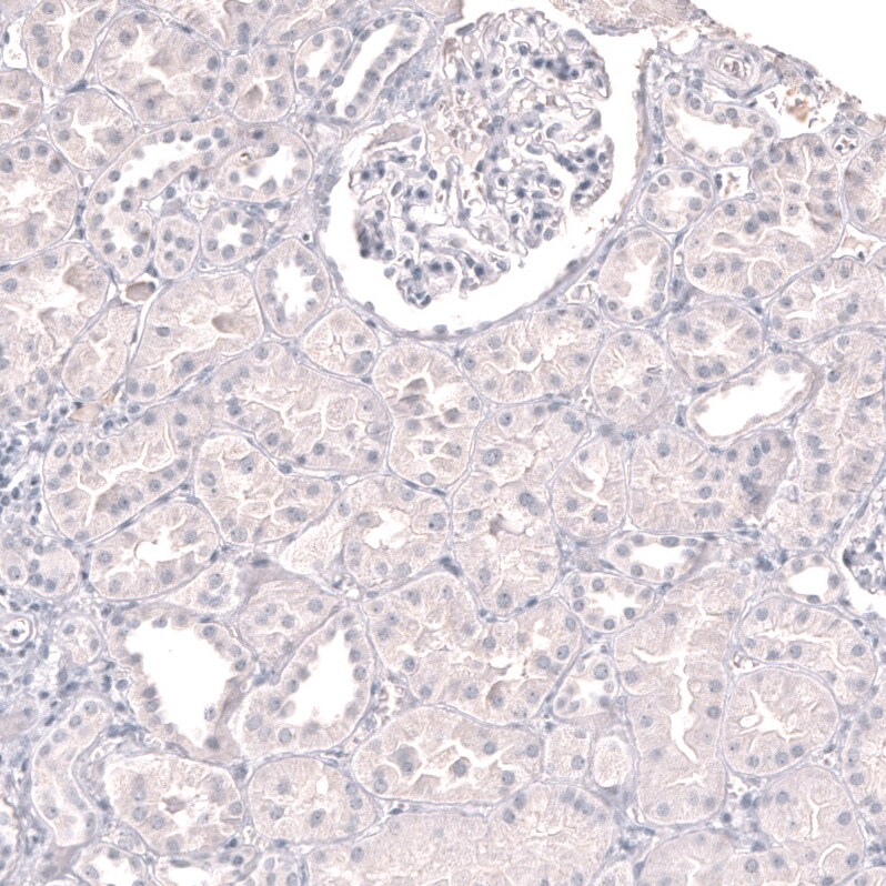 Myeloperoxidase/MPO Antibody (CL15002)