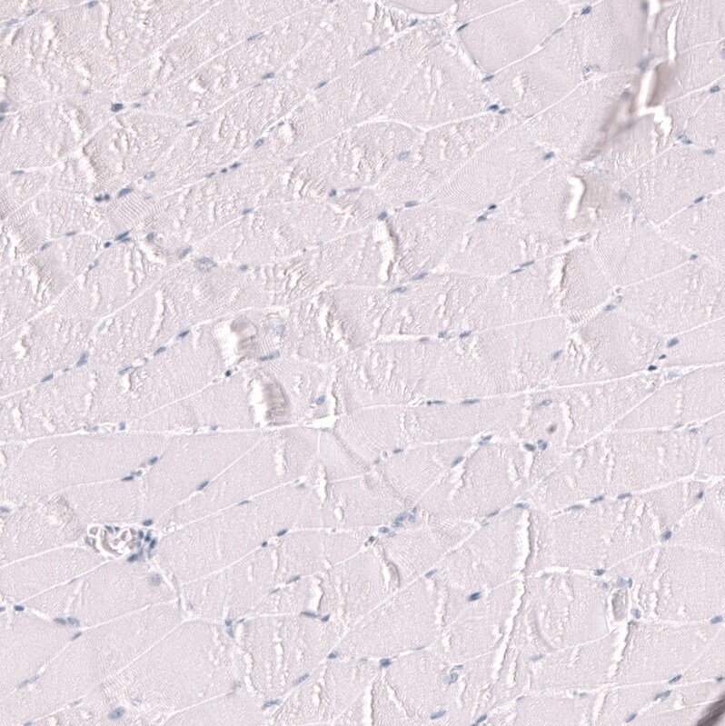 Myeloperoxidase/MPO Antibody (CL15002)
