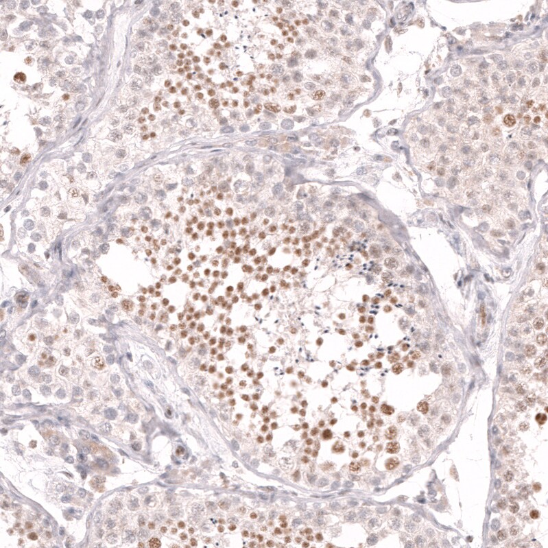 CDC2L6 Antibody (CL14116)