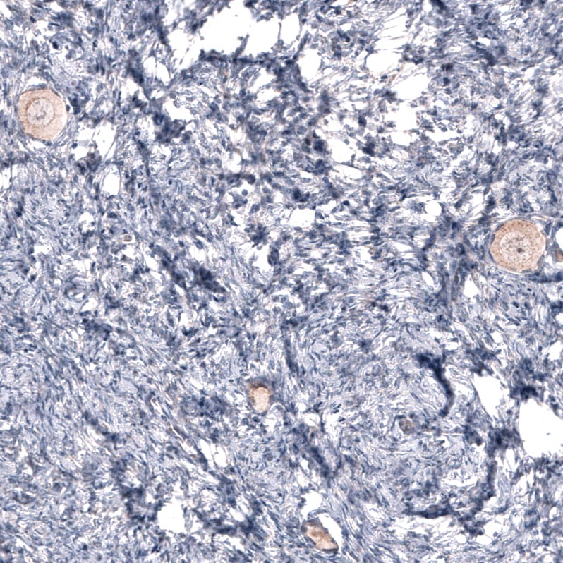 R-Spondin 2 Antibody (CL14321)