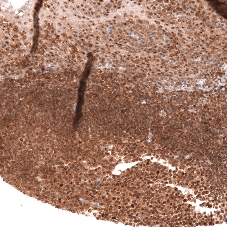 TFEB Antibody (CL14112)