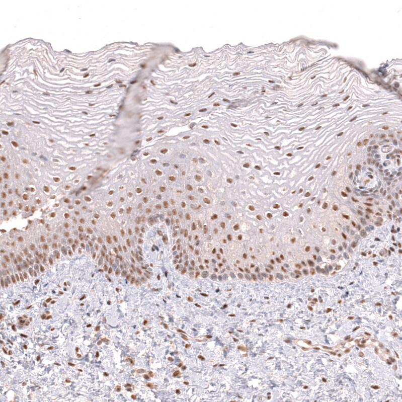 PRRX1 Antibody (CL14471)