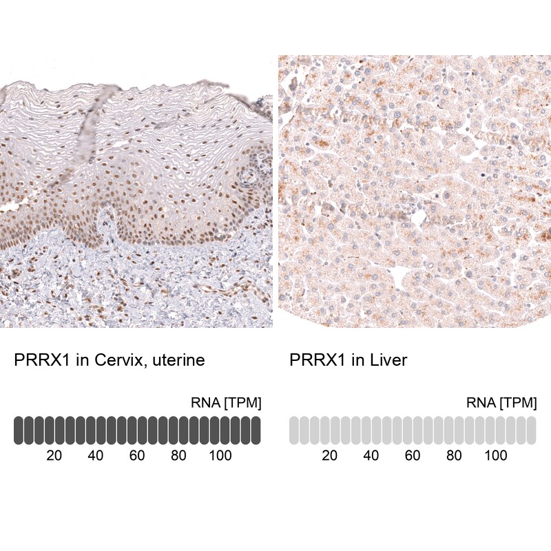 PRRX1 Antibody (CL14471)