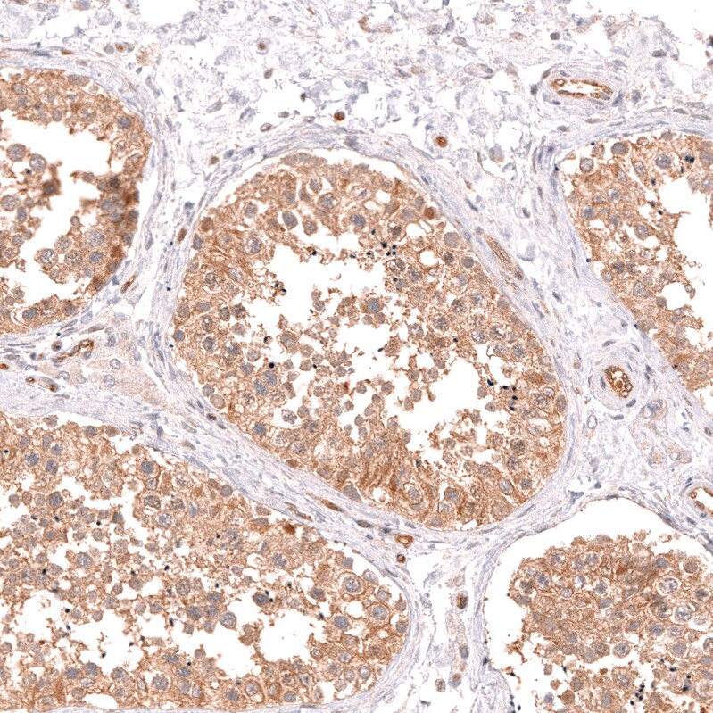 TYKi Antibody (CL14479)