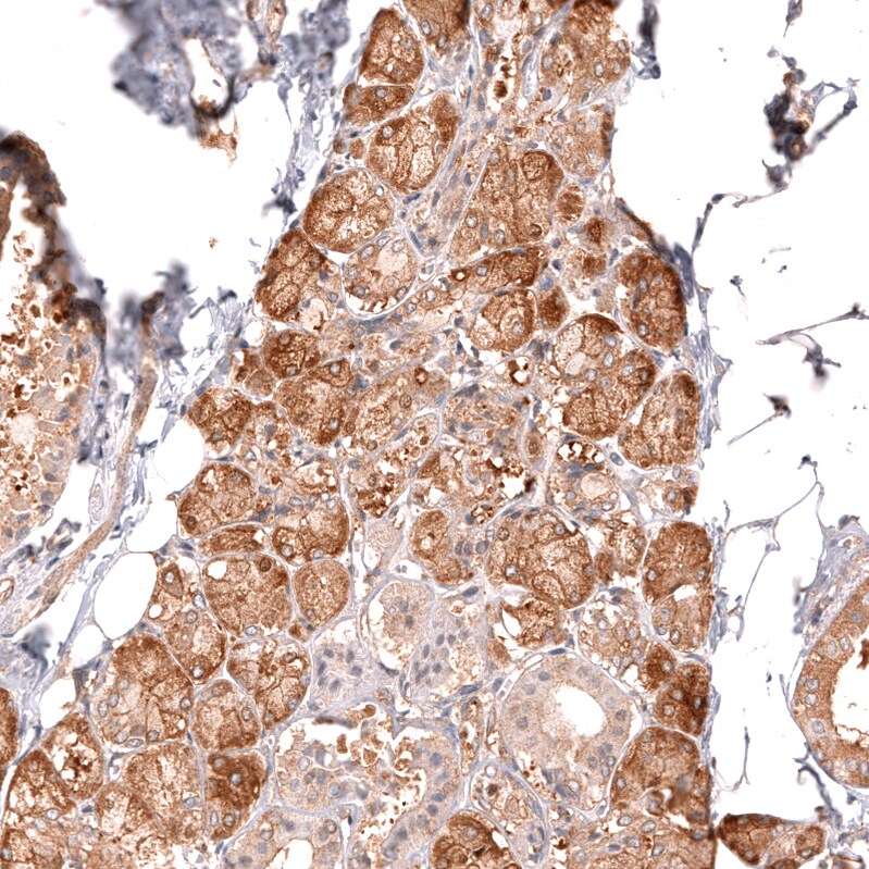 TYKi Antibody (CL14479)