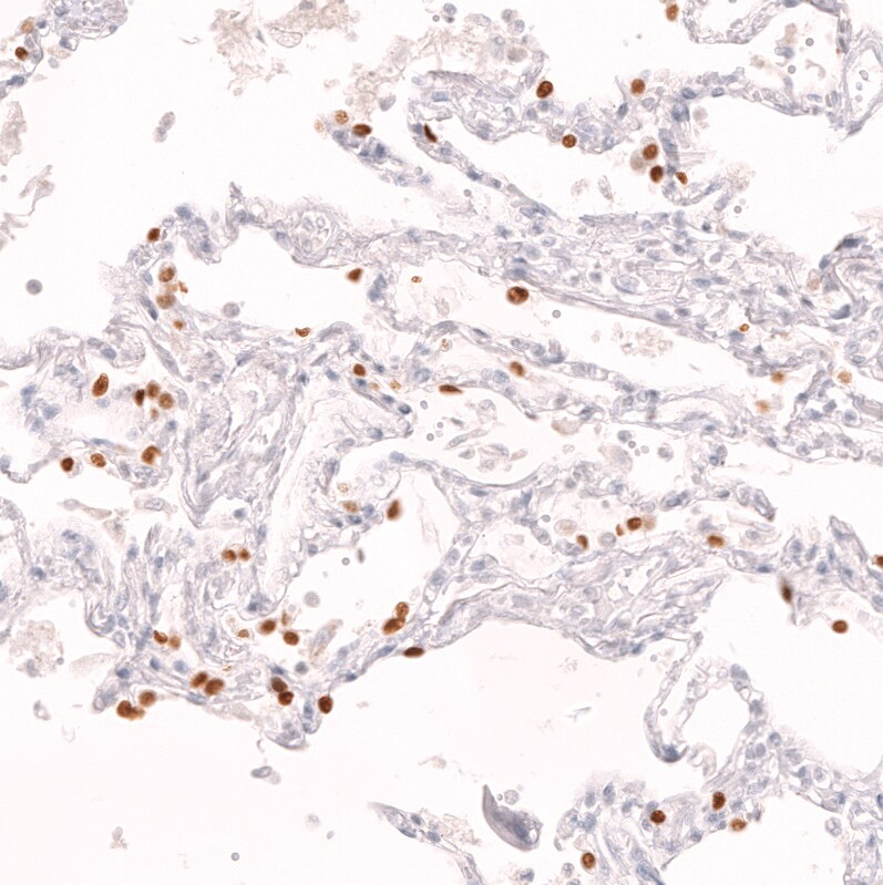 TTF-1 / NKX2-1 Antibody (CL14523)