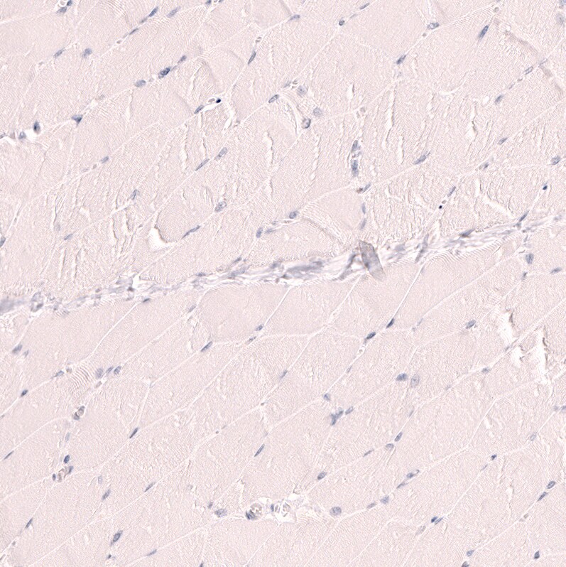 TTF-1 / NKX2-1 Antibody (CL14523)