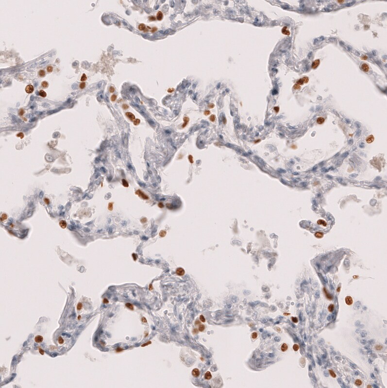 TTF-1 / NKX2-1 Antibody (CL14528)